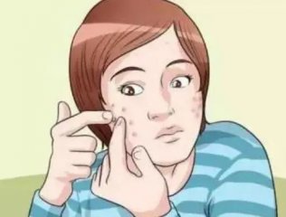 痘痘白色脓包不挤自己会好吗