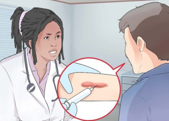 激光去一次疤要多少钱